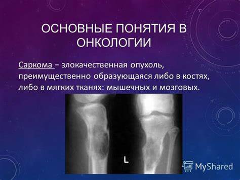 Онкология лечение диета Онкология Саркома 4 Стадия Диета — Похудение Диета Правильное Питание Онкология Саркома 4 Стадия Диета — Похудение Диета Правильное Питание Онкология лечение диета