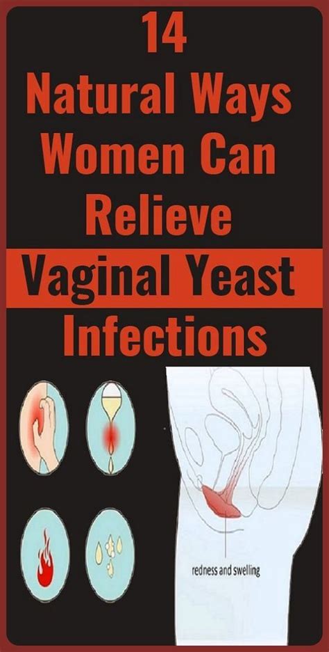 Natural Treatments For A Vaginal Yeast Infection