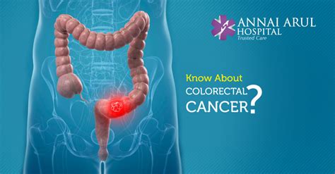 Know About Colorectal Cancer Multispeciality Hospitals In Chennai