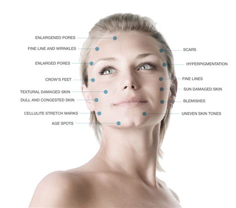 Microdermabrasion Dermesthetic Clinic