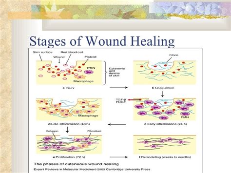 Wound Healing And Wound Care