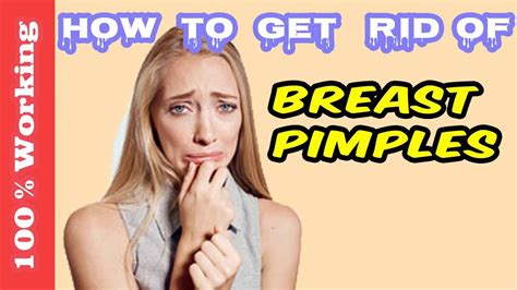 How To Get Rid Of Pimples On Breast Overnight Fast Home Remedies