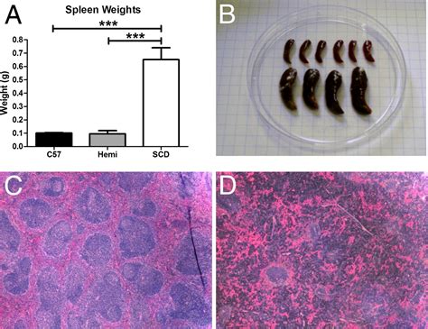 Splenic Morphological Changes Are Accompanied By Altered Baseline