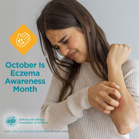 Eczema Awareness Month Adjusted Calendar Nicholas Calendar And