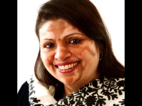 History Beckons Rita Patel As She Decides To Run For Leicester Mayor Post Indiaweekly