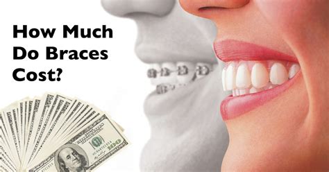 How Much Do Braces Cost Saddle Creek Orthodontics Dr Kyle