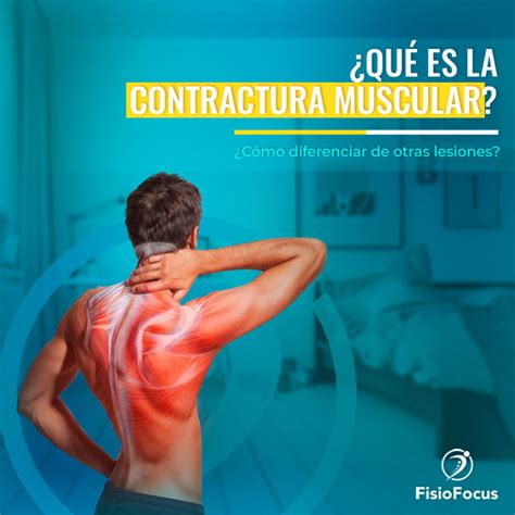 Contractura Muscular Síntomas causas y cómo prevenir FisioFocus