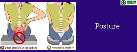 Best Tailbone Treatment Specialist Coccyx Pain Specialist