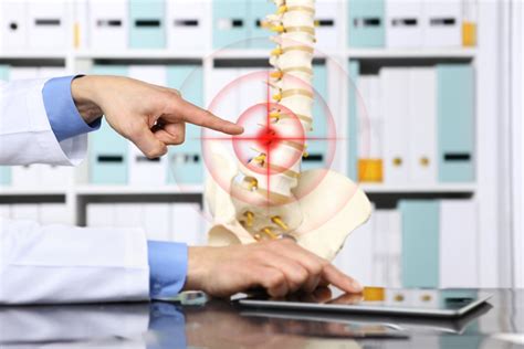 Spinal And Postural Screenings Pensacola Henry Chiropractic