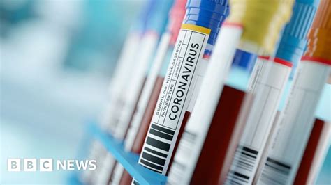 Coronavirus Deaths In Scotland Reach 40