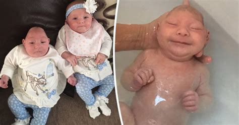 Miracle Baby Born Without 90 Of Brain Defies Medics Her Twin Cant