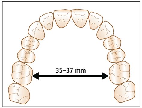 Principle 9 Establish Ideal Arch Form Pocket Dentistry