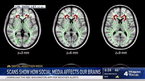 Digital Addiction Overuse Of Technology Can Rewire Your Brain Nbc4