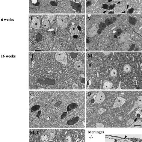 Correction Of Lysosomal Storage Lesions In The Brain Of Treated Mps Vii