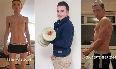 Anorexic Man In Preston Doubles His Size In Four Months With Body