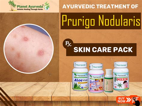 Treatment Of Prurigo Nodularis With Ayurveda