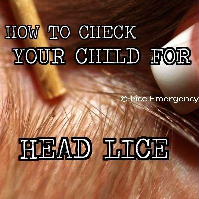 1000+ images about LICE! Head Lice Information on Pinterest
