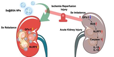 Selenium Nanoparticles Alleviate Ischemia Reperfusion Injury Induced