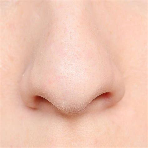 Skin Cancer On Nose Signs