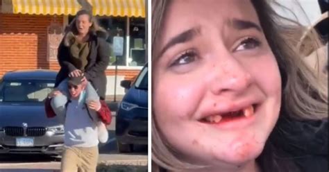Girl Loses Teeth During Boozy Brunch After Disastrous Tiktok Stunt