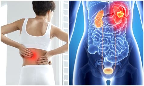 View Stabbing Kidney Pain You Should Know