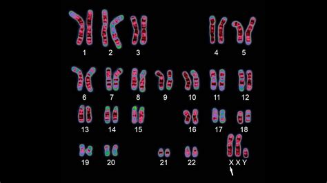 Chromosome Karyotyping Procedure Youtube