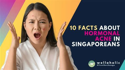 10 Facts About Hormonal Acne In Singaporeans