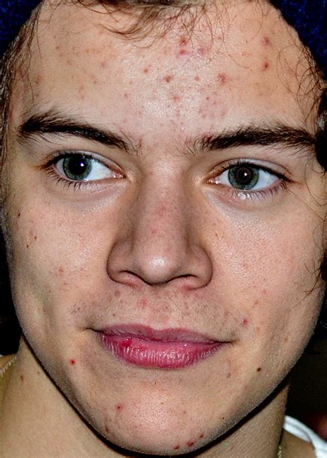 Celebrity Close-Up, A Collection of Unflattering, Extremely Close