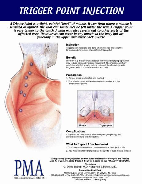 Trigger Point Injection (Read more )
