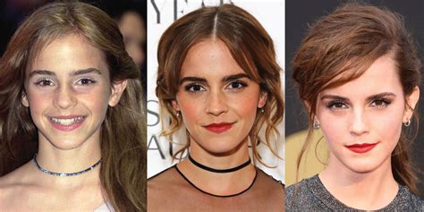 Emma Watson Plastic Surgery Before And After Pictures 2023