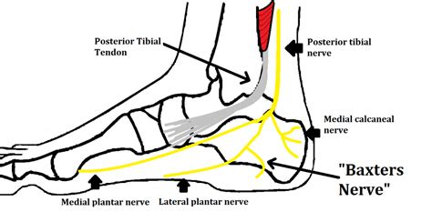 Medial Calcaneal Nerve Entrapment Baxters Neuritis Ankle Foot And