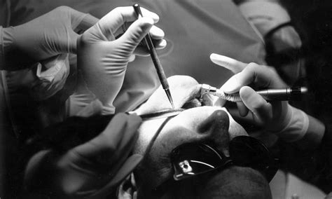 Dentist Suspended After Patient Dies While Having 20 Teeth Removed Us