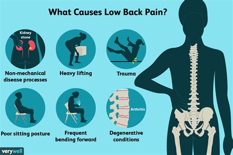 Lower Back Pain — Back Pain How To Live With One Of The Worlds