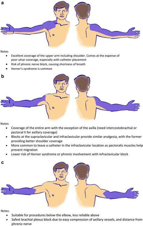 Anatomical Blocks Of The Upper Extremity Used In Burn Care A