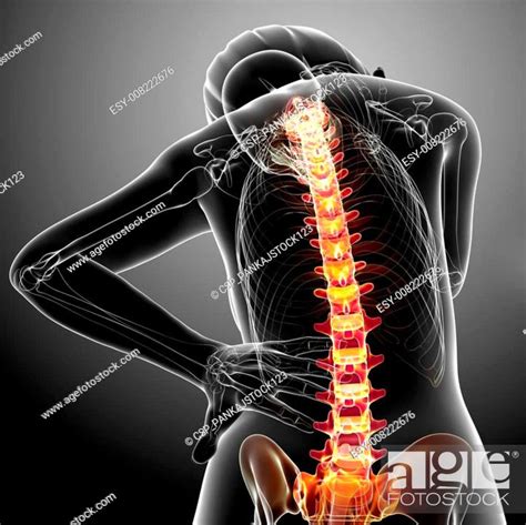 Female Back Pain Anatomy Stock Photo Picture And Low Budget Royalty
