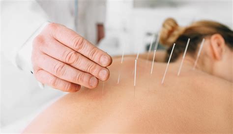 Vücudun belirli bölgelerine iğne batırılarak veyahut elektrik verilerek yapılan uzak doğu tedavi tekniği.müziklede hiçbir alakası yok. Akupunktur | Ihre Orthopädie Steglitz // MVZ Berliner ...