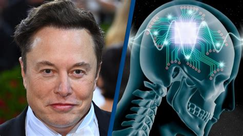 Elon Musks Neuralink Implants Wireless Brain Chip In Human