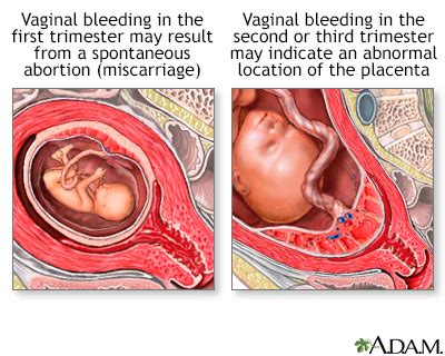 The third trimester is the home stretch of your pregnancy. Vaginal Bleeding During Pregnancy