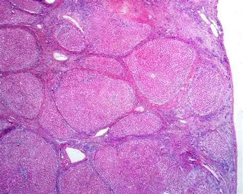 Scar Histology Stock Photos Free And Royalty Free Stock Photos From