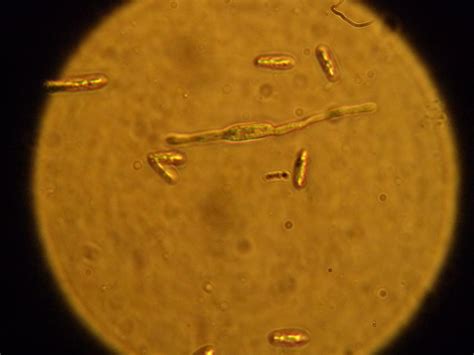 Konidia Colletotrichum Musae — Hai Ini Salbiah