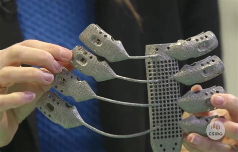 Cancer Patient Receives 3d Printed Ribs In Worlds First Surgery