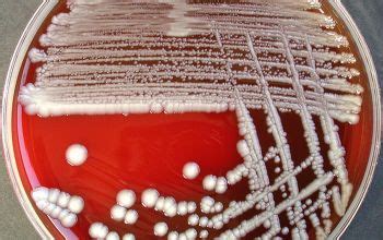 Raoultella ornithinolytica is a pathogen causing an increasing number of pediatric infections. Raoultella ornithinolytica