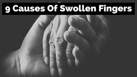 9 Causes Of Swollen Fingers Physio Insights