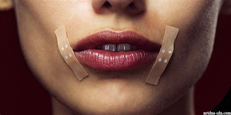Cracked Corners Of The Mouth Causes And Treatments Skin Care
