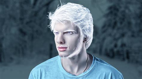 Descubrir 74 Imagen Modelo Albino Famoso Abzlocalmx