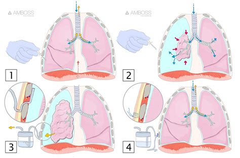 Heidrich h, ranft j, peters a. Immer neue Illustrationen in AMBOSS