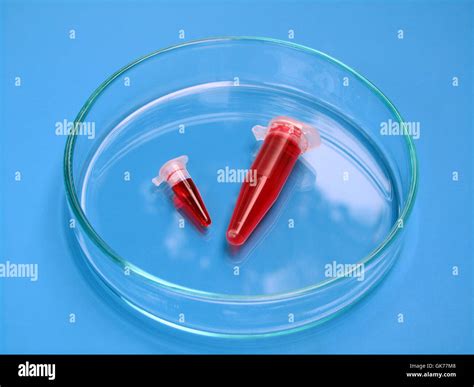 Blood Diabetes Petri Dish Stock Photo Alamy