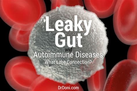 Leaky Gut And Autoimmune Diseases Whats The Connection Doctor Doni