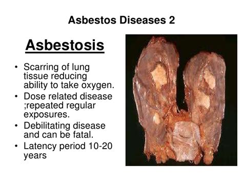The following is a list of notable deaths in march 2012. Mesotheolima 99: Asbestos Illness 2