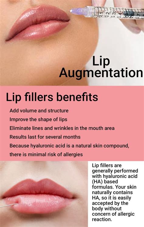 All Natural Ingredients In Lip Fillers You Can Expect Beautiful Natural